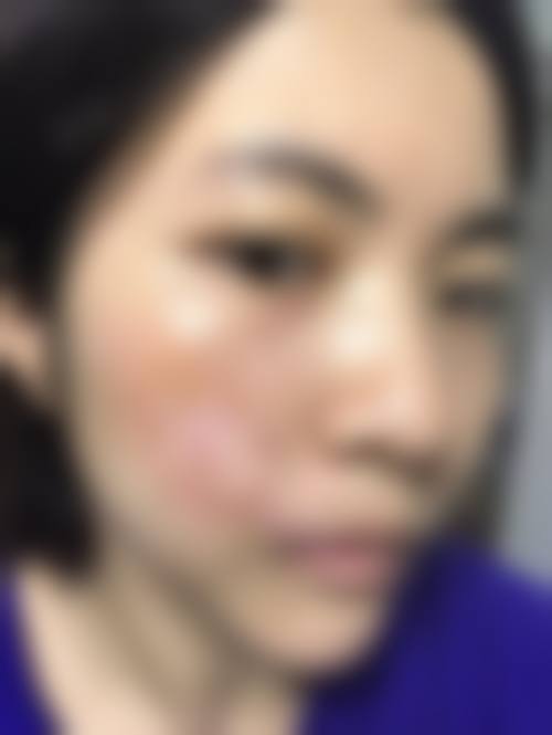 威海华僖医疗美容诊所擅长项目。