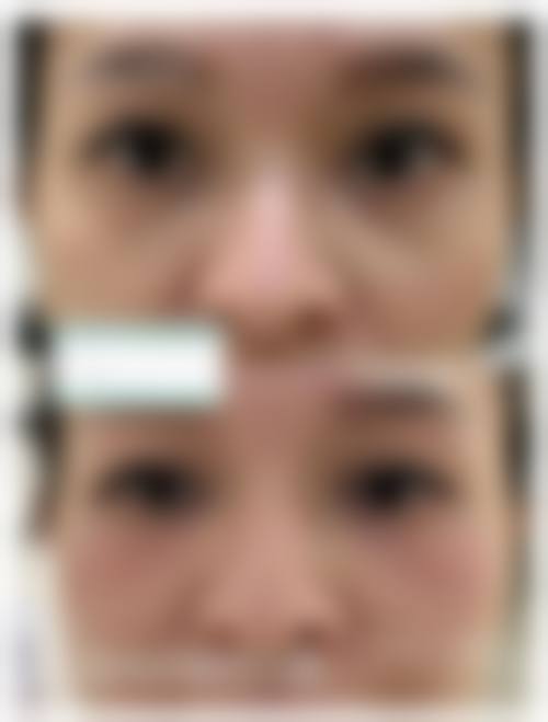 优惠活动详情