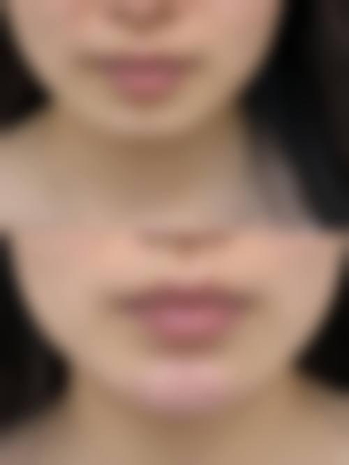 五、优惠活动详情:限时补贴等你来享