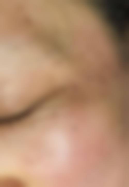 优惠活动详情