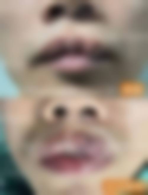 菏泽素颜医疗美容诊所擅长项目。
