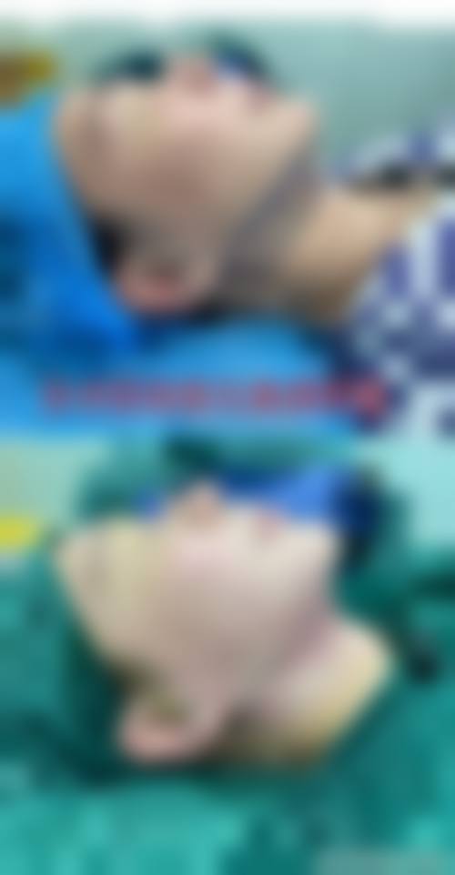 兰州宝黛医疗整形美容诊所擅长项目。