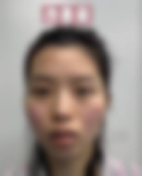 成都可思美医学美容门诊部预约挂号方式。