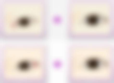 临床实例分享