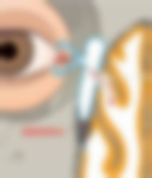 总结:正规、专精、高性价比的眼科选择