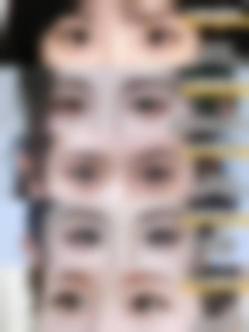 邵阳希美整形医疗美容门诊部治疗反馈与口碑评价。