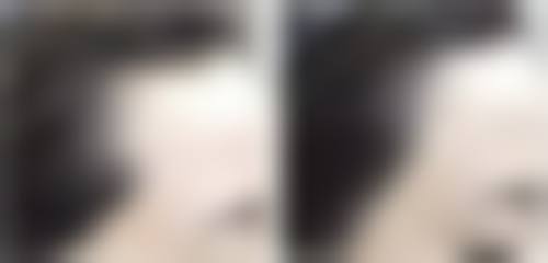 优惠活动详情:限时特别优惠,预约从速