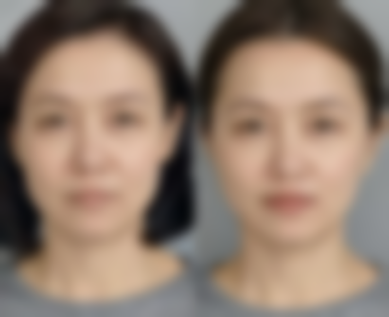 广州广美整形美容医疗门诊部擅长项目。