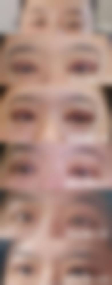 厦门市妇幼保健院医疗美容科擅长项目。