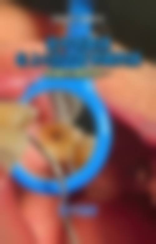 凤阳格瑞特口腔地理位置便于到院。