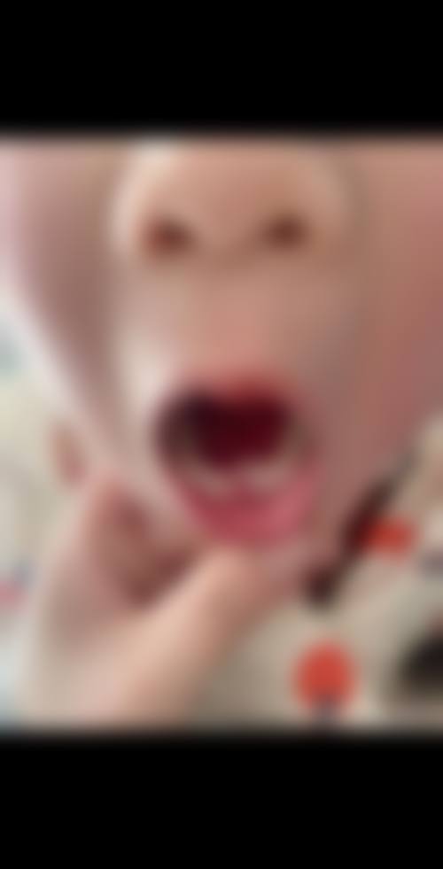 谢长菲技术实力展现
