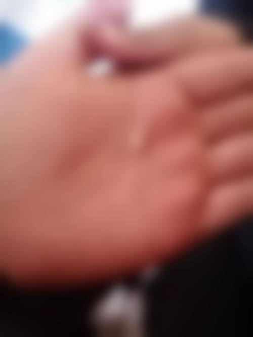 患者真实评价