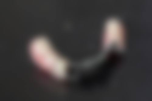 临床实例分享