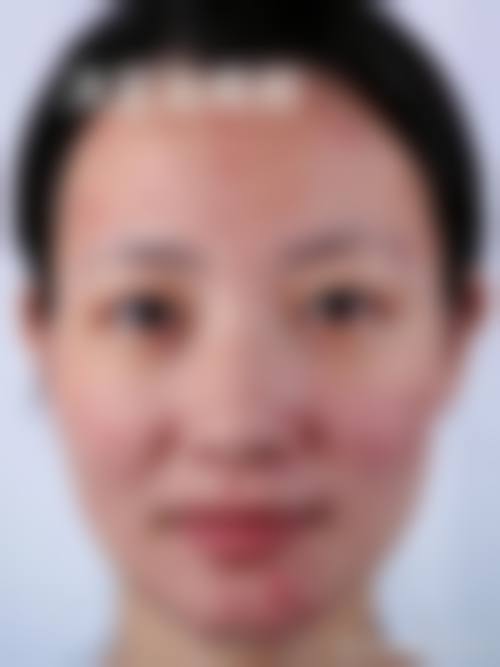 服务流程与保护:全程关怀,无忧变得更美