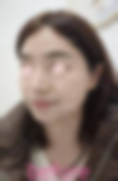 Q：手术安心吗？修复期需要多久？