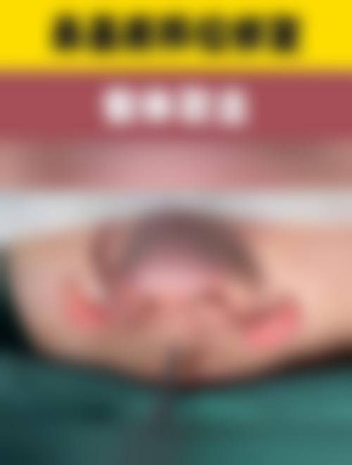 优惠活动：限时价格与预约说明