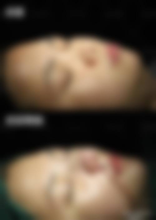 宜兴韩美人医疗美容诊所2026年价格收费表: