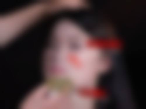 武汉达拉斯医疗美容门诊部陈先明医生患者评价