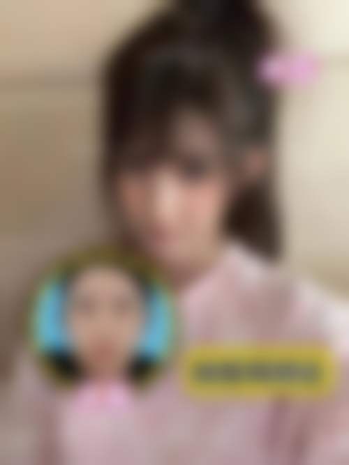 郑州爱美忻医疗美容门诊部杨国解医生眼部整形技术怎么样?
