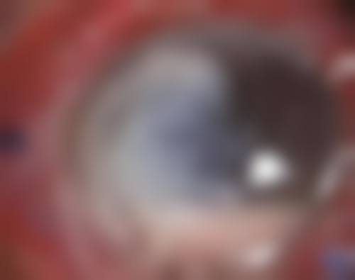 项目价格与优惠活动:透明收费,专属补贴