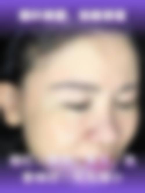 结尾——预约到院,开启美丽蜕变
