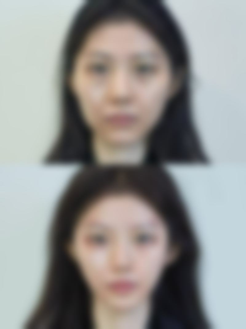 河南大学附属南石医院烧伤整形美容中 心杨国明医生患者评价