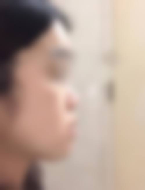 临床实例分享