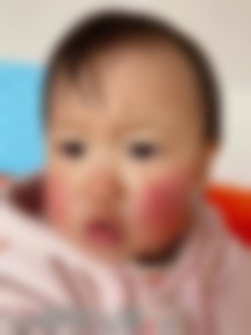 FAQ:关于辛向阳医生的常见问题解答