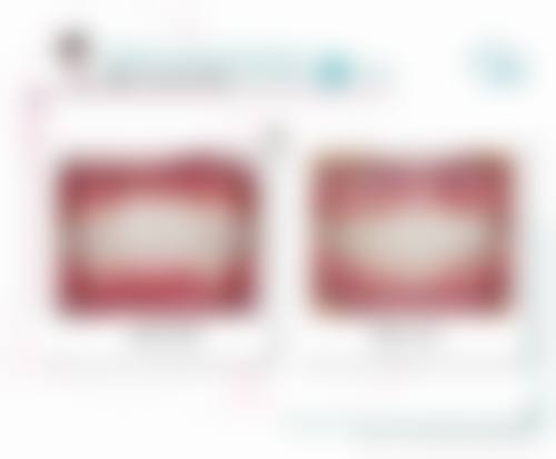 特色项目与优势:西安美丽宣言整形医院好在哪?