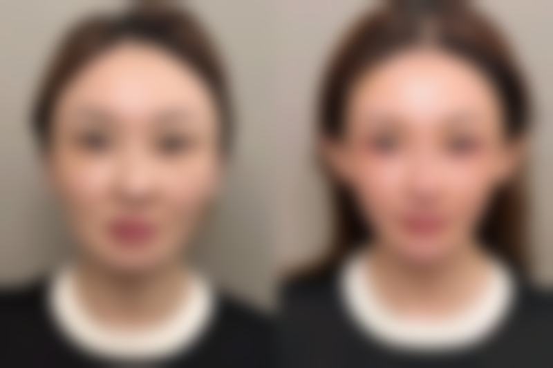 柳州市中医医院(皮肤科/医疗美容科)怎么预约
