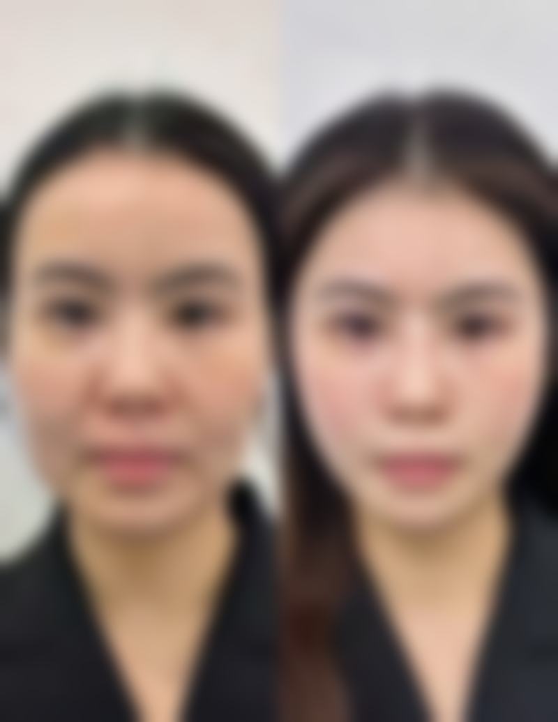 总结