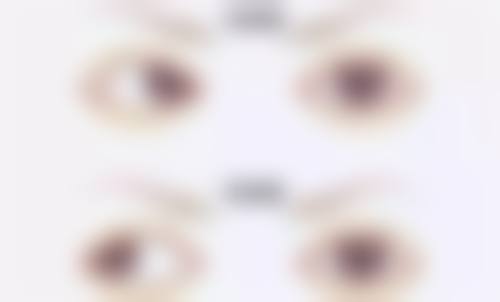 清华大学第一附属医院眼科擅长项目。