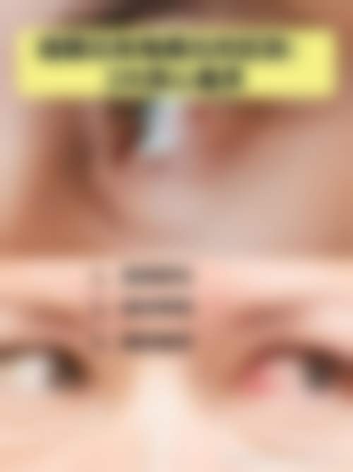 西安灞桥区人民医院眼科擅长项目。