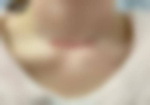 昆山豆蔻美容诊所擅长项目。