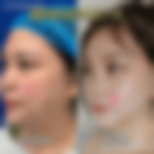 贵阳枫林晴医疗美容擅长项目。