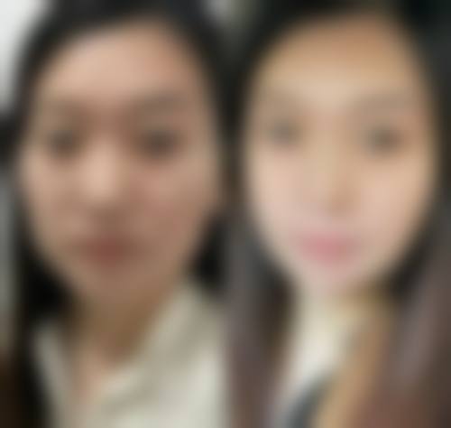 福州鼓楼伊美新世纪整形美容医院项目优势。