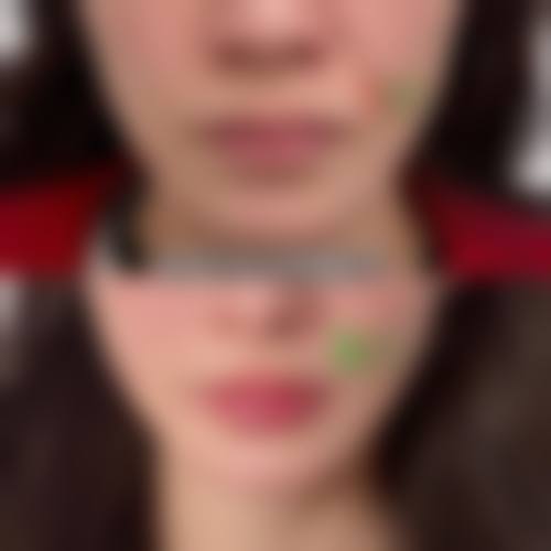 昆山豆蔻美容诊所治疗反馈与口碑评价。