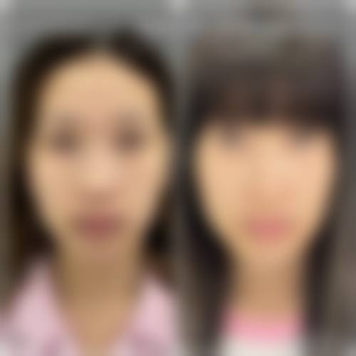 福州鼓楼伊美新世纪整形美容医院2026年价格收费表: