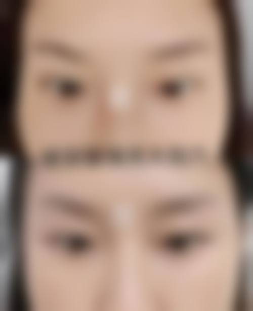 贵阳枫林晴医疗美容治疗反馈与口碑评价。