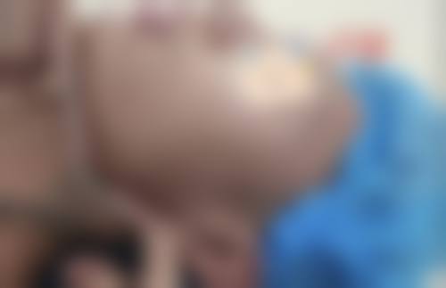 丛艳军 医生擅长项目详解
