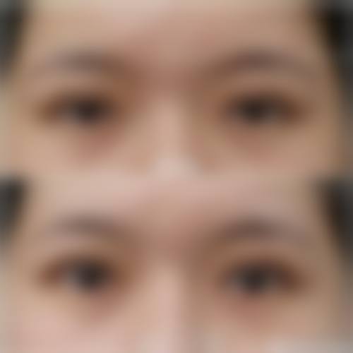福州鼓楼伊美新世纪整形美容医院擅长项目。