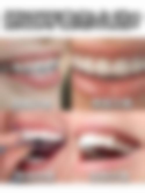 临床实例分享