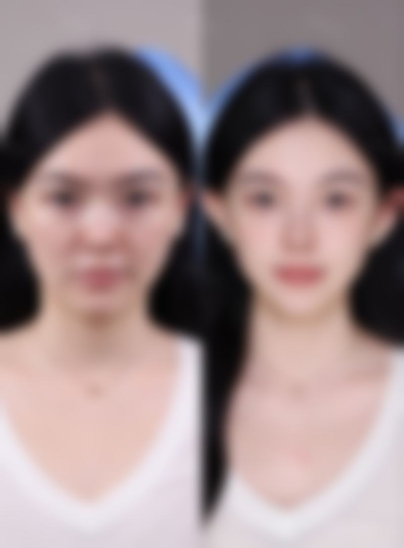 总结