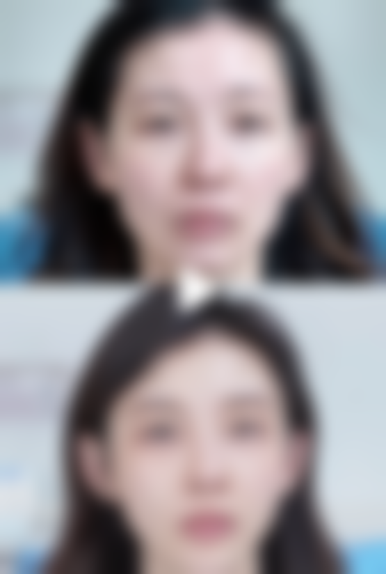 北京星源医疗美容医院马兰花医生患者评价
