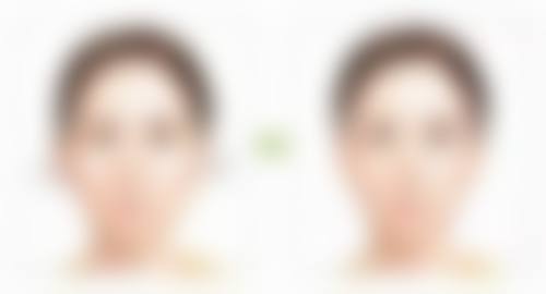 西安健丽医美郭东云医生患者评价