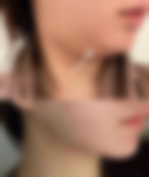 沈阳瑞利佳澜整形医院擅长项目。