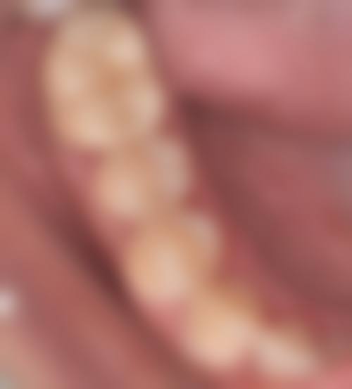 东莞大朗恒生口腔治疗反馈与口碑评价。