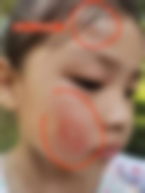 宝鸡市人民医院眼科擅长项目。