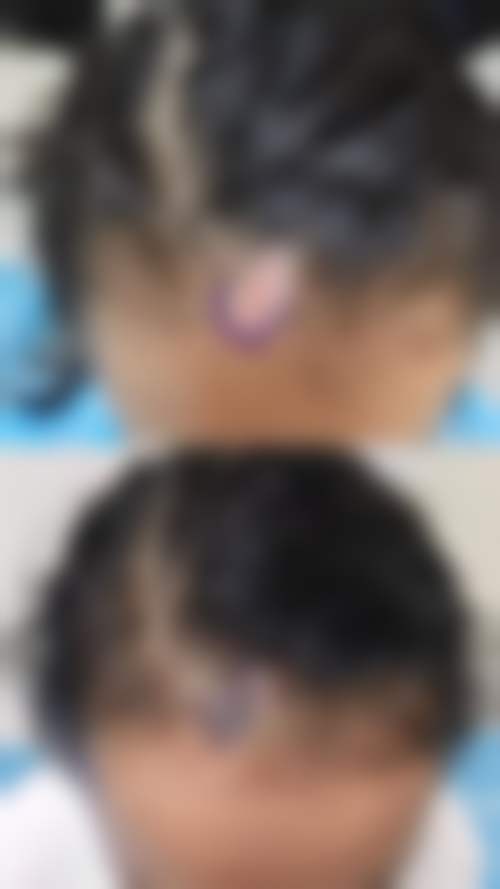 扬州俏华美医疗美容诊所高军飞医生:优质的术后服务