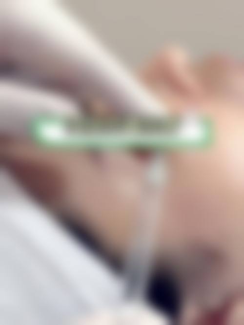 临床实例分享